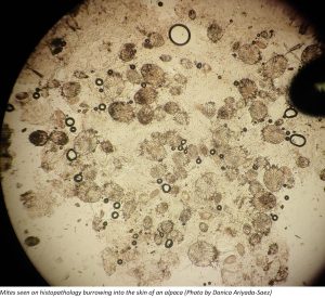 Mites seen on histopathology 01