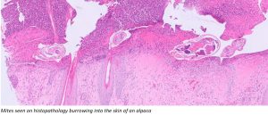 Mites seen on histopathology 02
