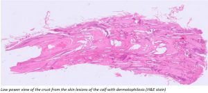 Skin lesions of the calf with dermatophilosis