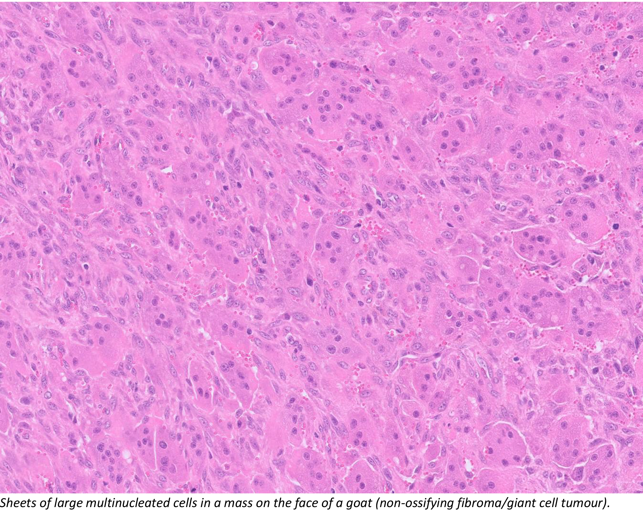 Brain stem of a sheep with listeriosis