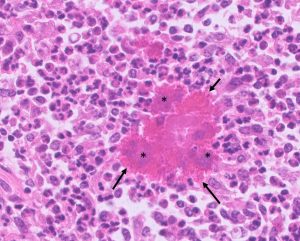 Small clusters of bacteria
