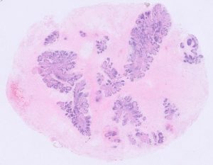 Thymic tissue from a reindeer