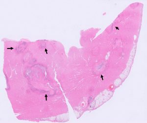 Multifocal areas