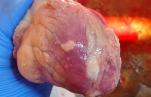 Pale lesions
