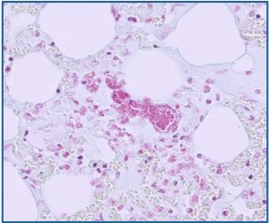 Sheep systemic pasteurellosis