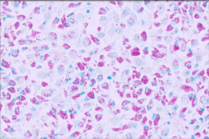 Abundant acid-fast bacteria