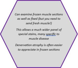 Advantages of specialist neuromuscular laboratory