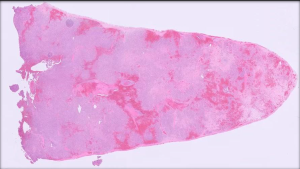 Low power view of the spleen