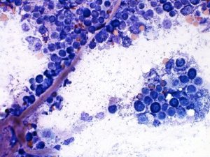 Figure 11 – Mast cells 