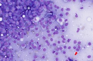 Figure 12 – Cytological features 