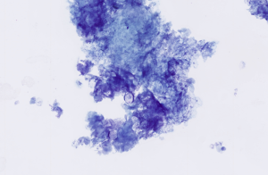 Figure 14 – Cytological features 