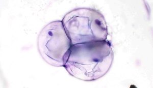 Figure 15 – Cytological features 