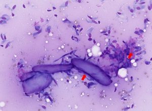 Figure 16 – Cytological features 