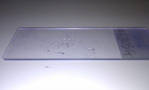 Figure 2. A very thin FNA smear