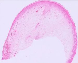 A cross-section of a penile fibropapilloma