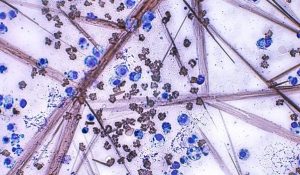 Figure 5. Haemolysis artefact