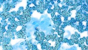 Figure 6. Formalin fume artefact 