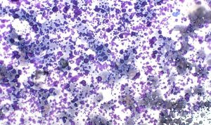 Figure 7. Ultrasound or lubricating gel 