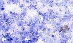 Figure 8. Necrotic material 